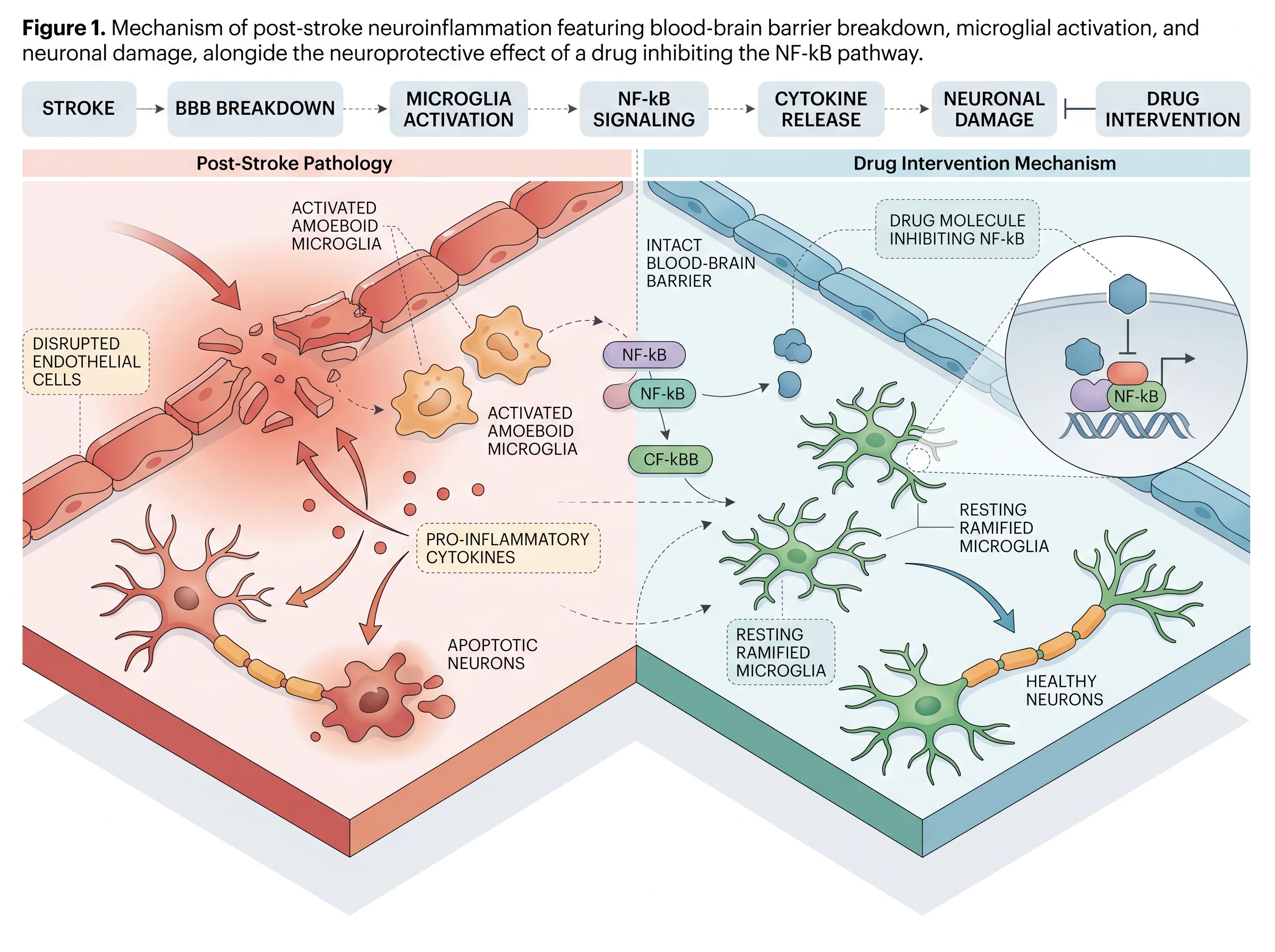 Stroke Neuroinflammation Mechanism
